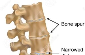 Dieta antiinflamatoria con el nutricionista Simran Nanwani | Indonesia fisioactiva Anti-inflammatory diet with Nutritionist Simran Nanwani | PhysioActive Indonesia