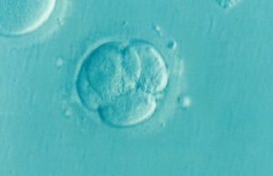 ¿Quieres el precio de la FIV, el precio es costoso? Los médicos revelan que este método puede reducir los costos ¿Quieres el precio de la FIV, el precio es costoso? Los médicos revelan que este método puede reducir los costos