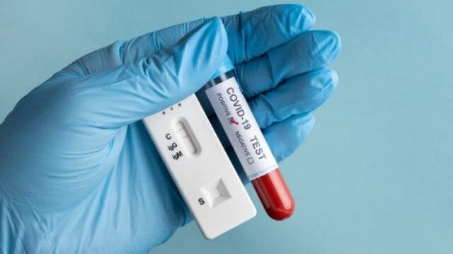 Ilustrasi COVID-19/virus corona