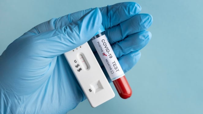 Ilustrasi COVID-19/virus corona