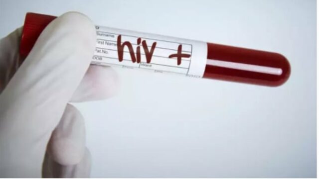 ¡Triste! Alrededor de 2.700 adolescentes de 15 a 19 años en Indonesia infectados con el VIH

