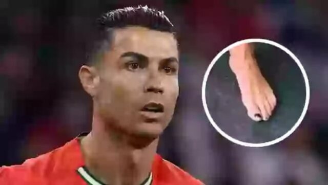 El secreto detrás de las uñas con los dedos negros de Cristiano Ronaldo resulta ...

