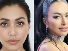 Los rangos de artistas indonesios experimentan francamente la operación de la rinoplastia y sus razones

