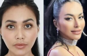 Ventajas y desventajas distribuidas después de haber decidido una cirugía de nariz, Denada Santuy: Estoy satisfecho con los resultados Los rangos de artistas indonesios experimentan francamente la operación de la rinoplastia y sus razones