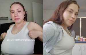 La mujer se vuelve viral en Tiktok por compartir la historia de la reducción de los senos de «salvación de vidas». Vea las fotos antes y después (exclusivo) La mujer se vuelve viral en Tiktok por compartir la historia de la reducción de los senos de "salvación de vidas". Vea las fotos antes y después (exclusivo)