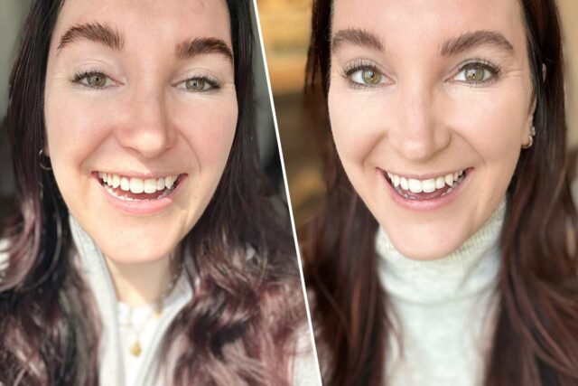 Las bandas blanqueadoras que juro están en Amazon desde $ 14

