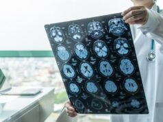 Existe una diferencia vital en cómo Medicare y Medicare Advantage previenen y tratan los accidentes cerebrovasculares. Lo que necesitas saber.
| Existe una diferencia vital en cómo Medicare y Medicare Advantage previenen y tratan los accidentes cerebrovasculares. Lo que necesitas saber.
|