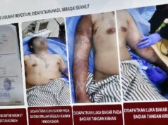 TAUD insta a Prabowo a formar un equipo para investigar el caso de Andrie Yunus
| TAUD insta a Prabowo a formar un equipo para investigar el caso de Andrie Yunus
|