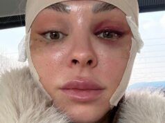 Me hice un lavado de cara cuando tenía treinta años. Fui a Corea del Sur para esto.
| Health,as-told-to,health,cosmetic-surgery,millennial,seoul,plastic-surgery,mini-facelift Me hice un lavado de cara cuando tenía treinta años. Fui a Corea del Sur para esto.
| Health,as-told-to,health,cosmetic-surgery,millennial,seoul,plastic-surgery,mini-facelift