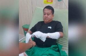 Víctimas del ataque con ácido de Bangka Belitung serán operadas
| Víctimas del ataque con ácido de Bangka Belitung serán operadas
|