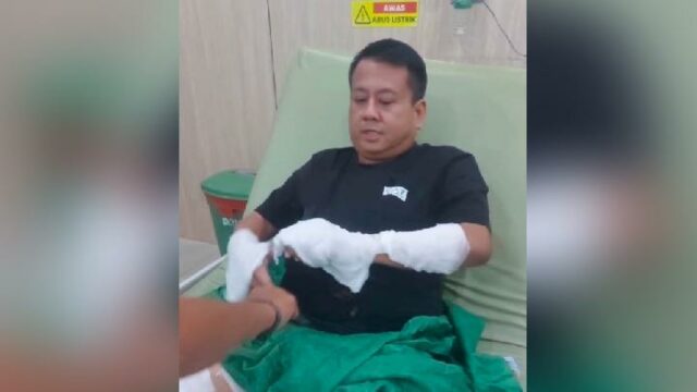 Víctimas del ataque con ácido de Bangka Belitung serán operadas Víctimas del ataque con ácido de Bangka Belitung serán operadas
|