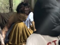 En caso de emergencia, el gobierno de la ciudad de Semarang apoya inmediatamente a los niños maltratados
| En caso de emergencia, el gobierno de la ciudad de Semarang apoya inmediatamente a los niños maltratados
|