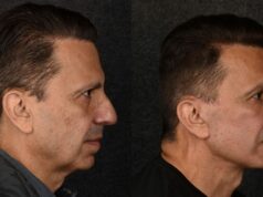 La C-Suite paga mucho dinero para parecer accesible y menos irritable
| Healthcare,plastic-surgery,c-suite,hot-at-work La C-Suite paga mucho dinero para parecer accesible y menos irritable
| Healthcare,plastic-surgery,c-suite,hot-at-work