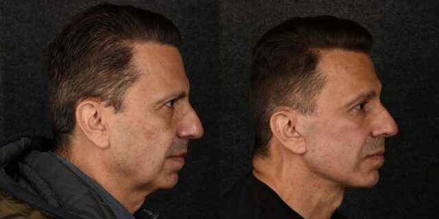 La C-Suite paga mucho dinero para parecer accesible y menos La C-Suite paga mucho dinero para parecer accesible y menos irritable
| Healthcare,plastic-surgery,c-suite,hot-at-work