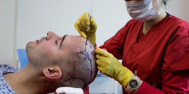 ¿Por qué los trasplantes de cabello son tan caros?

 | Health,video,so-expensive,video-format-so-expensive,new-this-week,new-this-week-video