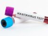 Los legisladores del PDIP piden al gobierno que aplique el enfoque de «una sola salud» para desconfiar del hantavirus
| Los legisladores del PDIP piden al gobierno que aplique el enfoque de "una sola salud" para desconfiar del hantavirus
|