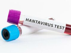 Los legisladores del PDIP piden al gobierno que aplique el enfoque de «una sola salud» para desconfiar del hantavirus
| Los legisladores del PDIP piden al gobierno que aplique el enfoque de "una sola salud" para desconfiar del hantavirus
|