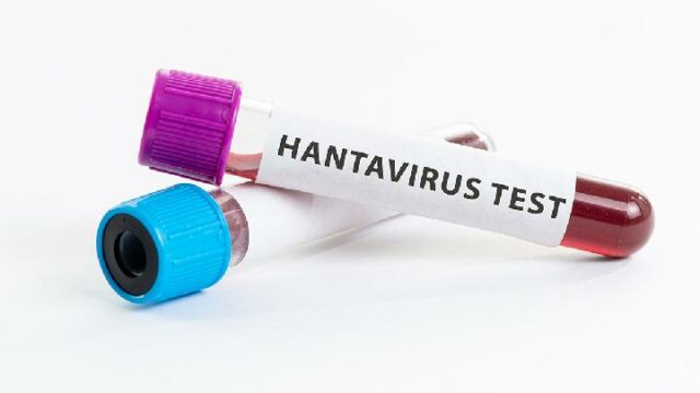 Los legisladores del PDIP piden al gobierno que aplique el enfoque de "una sola salud" para desconfiar del hantavirus

 | 