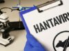 Directrices del Ministerio de Salud para la prevención y el control del virus Hanta
| Directrices del Ministerio de Salud para la prevención y el control del virus Hanta
|