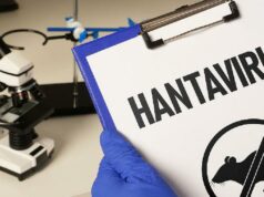Directrices del Ministerio de Salud para la prevención y el control del virus Hanta
| Directrices del Ministerio de Salud para la prevención y el control del virus Hanta
|
