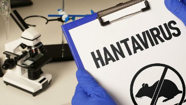 Directrices del Ministerio de Salud para la prevención y el Directrices del Ministerio de Salud para la prevención y el control del virus Hanta
|