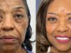 Se hizo un lavado de cara de 102.000 dólares a los 71 años; Ojalá hubiera podido permitirme esto hace diez años.
| Health,as-told-to,health,plastic-surgery,los-angeles,hot-at-work Se hizo un lavado de cara de 102.000 dólares a los 71 años; Ojalá hubiera podido permitirme esto hace diez años.
| Health,as-told-to,health,plastic-surgery,los-angeles,hot-at-work