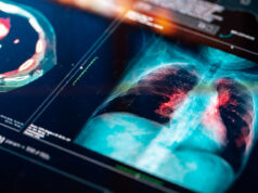 «El reinado del rey Keytruda continúa». Los inversores no están impresionados con un nuevo y prometedor fármaco contra el cáncer de pulmón.
| "El reinado del rey Keytruda continúa". Los inversores no están impresionados con un nuevo y prometedor fármaco contra el cáncer de pulmón.
|