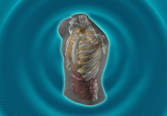 Esta empresa de inteligencia artificial quiere reemplazar las resonancias magnéticas con un baño de 60 segundos en el spa. ¿Puede realmente funcionar?

 | 